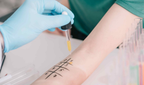 Allergy Testing: How It Works and Who Actually Needs It