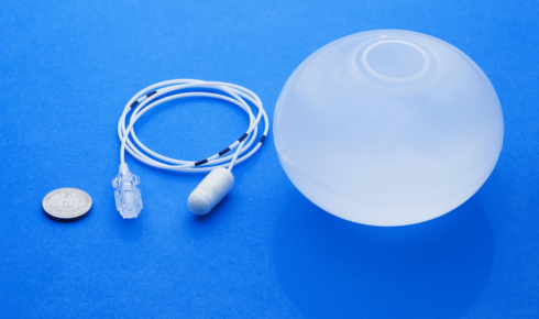 What It Really Costs to Choose a Gastric Balloon — And Whether It’s Worth It